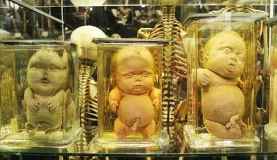 福尔马林是什么与尸体共舞的不腐之秘甲醛的水溶液