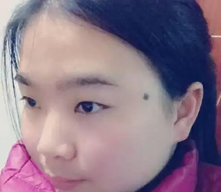 痣看女人运女人身上哪些地方有痣对运势有帮助一生有好运