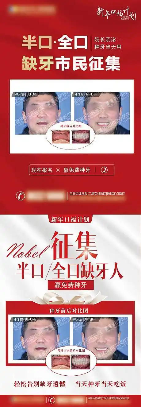 缺牙半口全口种植牙展架psd广告设计素材海报模板免费下载-享设计