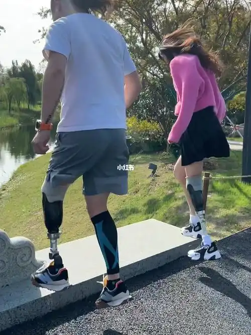 假肢女孩  #截肢  #小腿假肢  #康复  截肢之后还能做什么