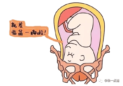 胎儿入盆会疼吗肚子下垂耻骨疼是不是入盆了