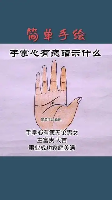 你知道手掌心有痣暗示什么吗?