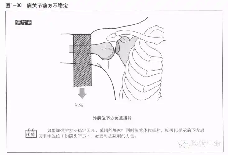 肩关节x线检查体位大全