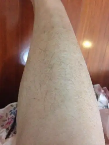 请问如何才能让小腿皮肤回