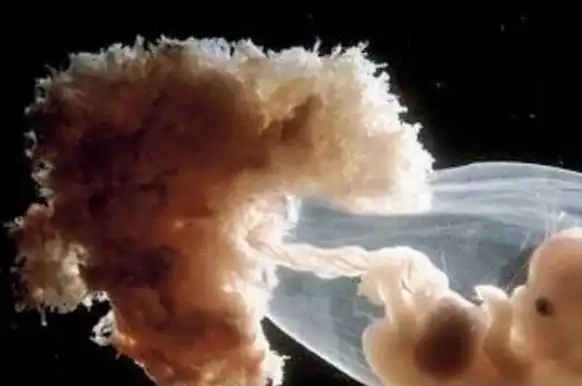 孕期这三个时间段,是胎儿智力发育的高峰期,孕妇别错过