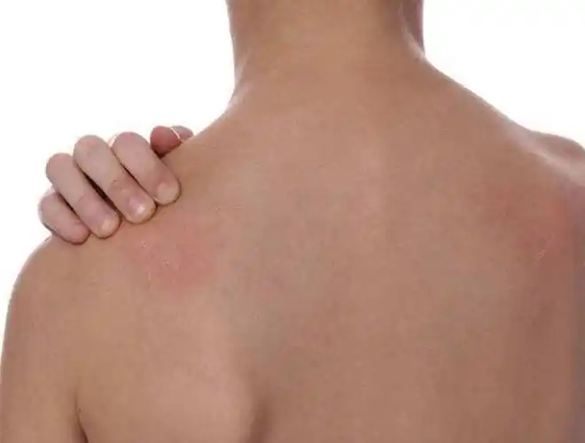 艾滋病来了,皮肤上会有这种"信号"!多加留意_身体_原因_症状