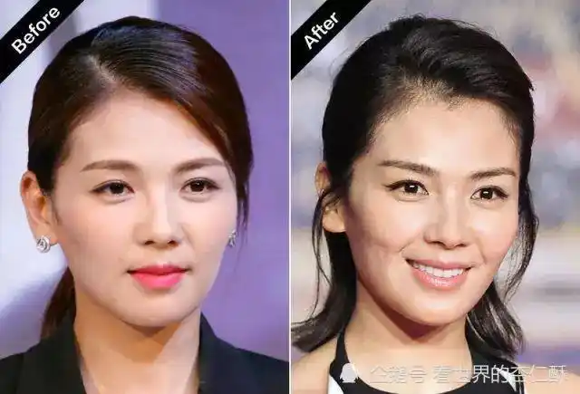 刘涛高颧骨女星的颜值沉浮