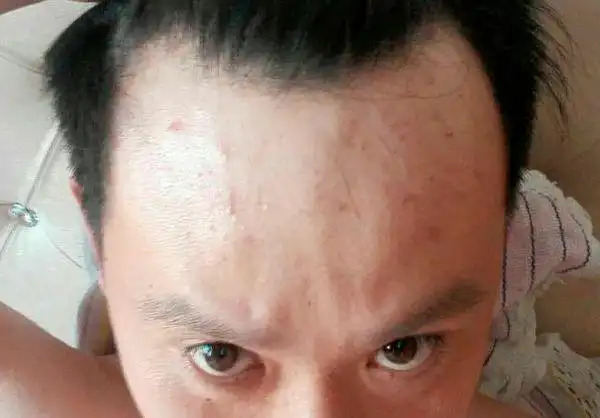 秃额角,留个什么样的发型好看.不要长发.