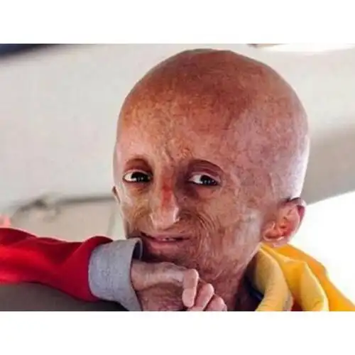 世界上最恐怖的十大疾病染上必死无疑胆小勿看