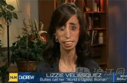 【"世界最丑女人"出书励志走出阴影】