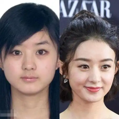 10位素颜女星前后对比,哪位才是你素颜女神