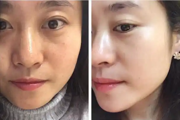 宝露斯韩式微雕平肤修护套:唤醒皮肤自我修复_宝露斯护肤品牌官网