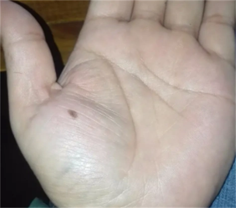 男人左手掌有痣好不好 左手掌边缘长出一颗痣是什么意思-善吉算命网