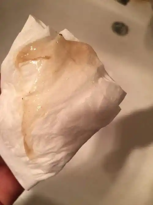 白带多像水一样流出来怎么办 白带多像水一样流出来怎么回事