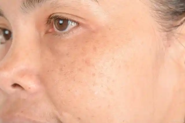 皮肤暗黄又显老,耐心看完很重要