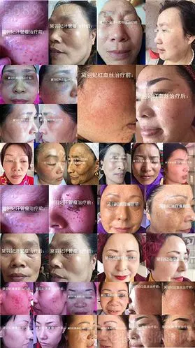 疫情有爱丨黛羽妃32种问题性皮肤免费实操技术培训等你来!