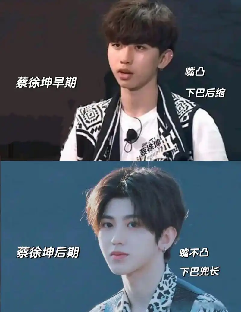 蔡徐坤# 蔡徐坤出道前后图片对比,这差的有点大啊!