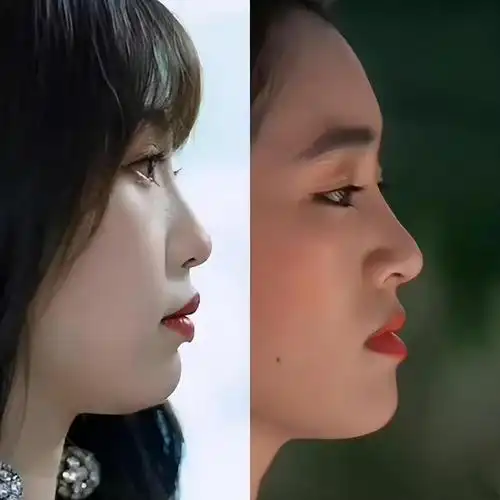 凸嘴,短下巴,塌鼻梁,面部凹陷…这些女星侧脸也太真实了