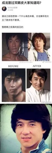成龙大哥的双眼皮是割的呐?