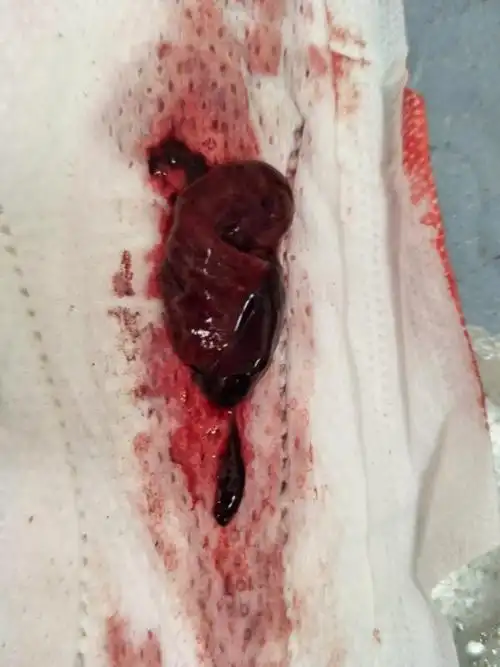 来月经流这个是怎么回事?