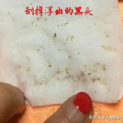 之前挤黑头把鼻子挤出好多洞特别是图上那个超级大 今天实在受不了就