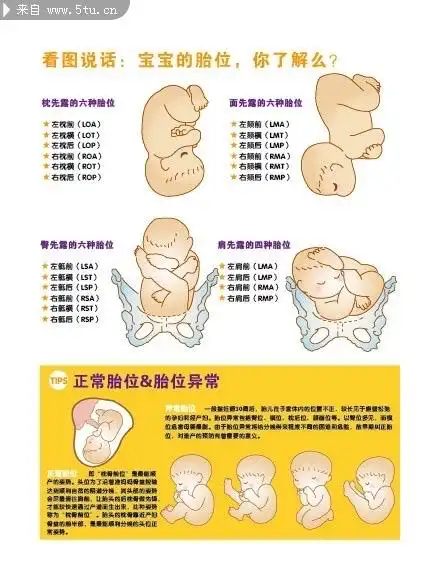 张主任告诉大家,胎儿在哪个月份胎位就固定了,胎位不正该怎么办?