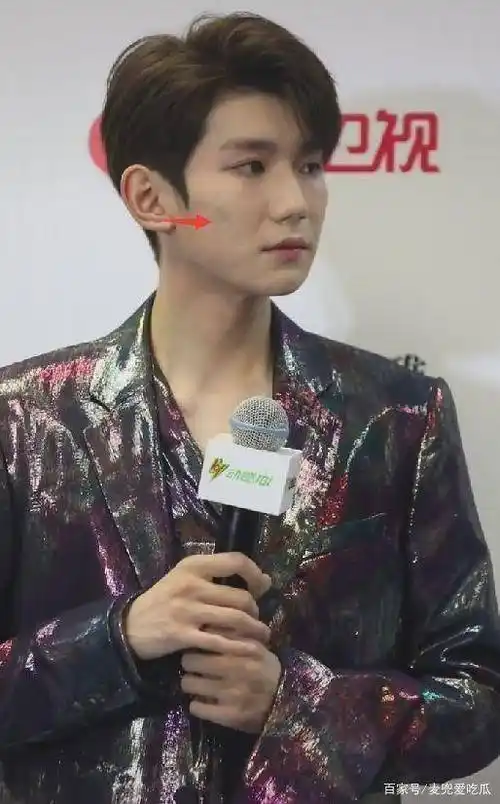 王源出席活动宣传新歌皮肤状态再引热议美颜都盖不住痘印