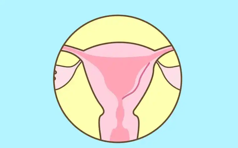 促排取卵顺利,胚胎移植后却没怀孕 到底是谁的错?_子宫_治疗_内膜