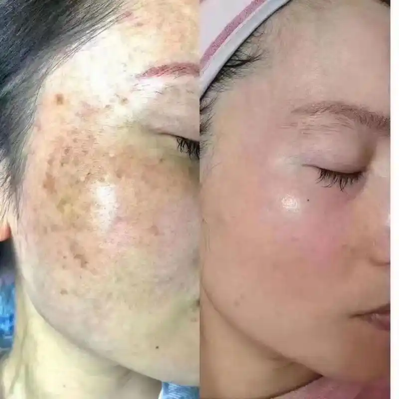 问题性皮肤管理 #解决任何皮肤问题 #告别肌肤问题 #同城 - 抖音