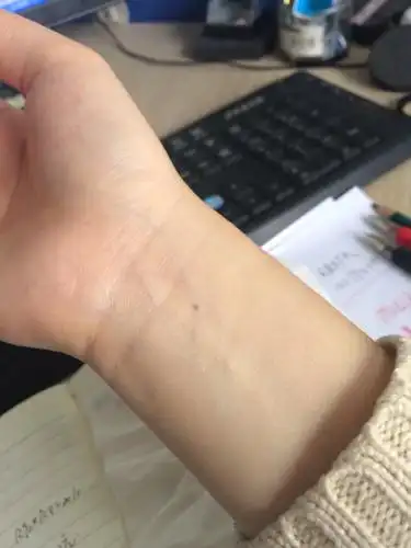 右手手腕正中一颗痣,什么意思?女生.纯粹好奇~唉上班太无聊了
