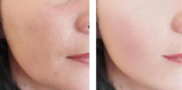 敏感,毛孔粗大,出油多……常见的皮肤问题汇总1