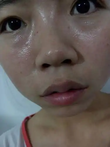 我的皮肤角质层是不是太薄,请问这样的皮肤要怎样护理?