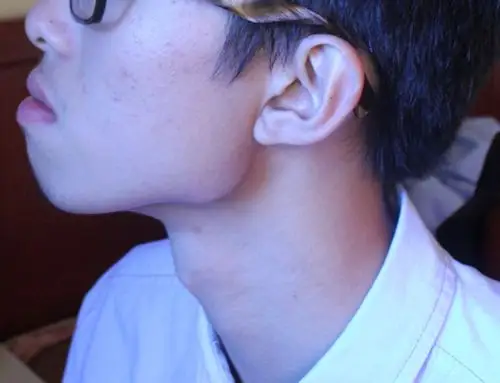 总感觉自己的下巴还有耳朵下面那块骨头突出有什么办法掩饰没有?