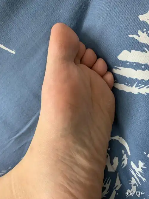 5岁小朋友脚很臭怎么办