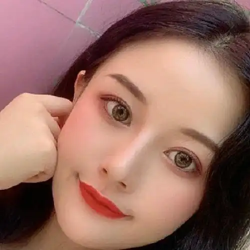 这次做双眼皮非常成功,成功变成双眼皮大眼睛的妹子,_圈子-新氧美容