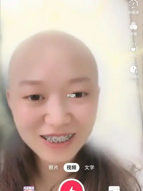 "我觉得我现在笑起来很不自然""笑起来我看看"(呲牙笑)"挺好的呀 后期