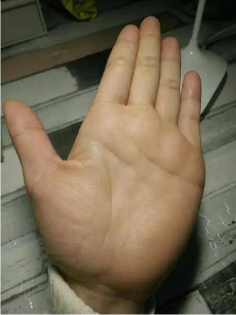 生命线短注定是短寿之人的手相