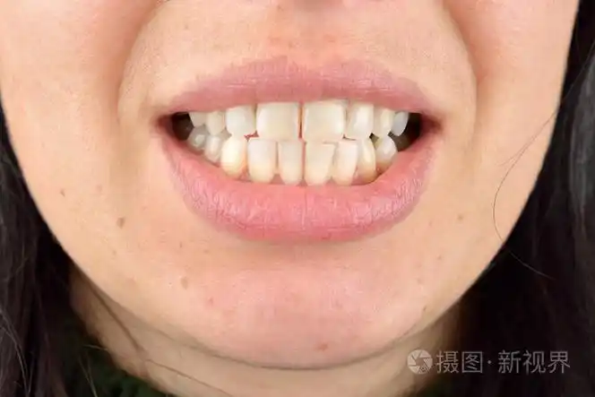 健康的牙齿的年轻女人的特写牙科保健服务hy