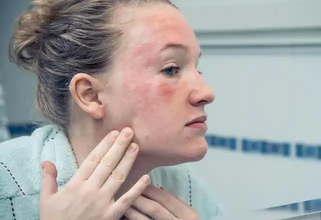 首页 美容 护肤敏感皮肤和医学上的"过敏性皮肤".