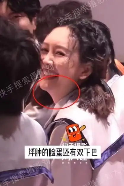 王鸥复工状态空降热搜,脸部发福双下巴明显,何炅下意识看其肚子