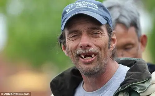 美国"犬牙男"威胁吃掉乞丐被捕