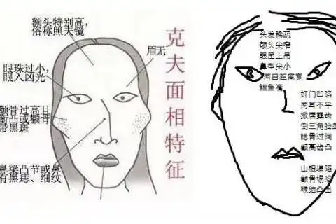 女人克夫感情不顺面相图解大全