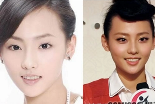 张嘉倪个人资料简介 张嘉倪整过容吗真相揭秘