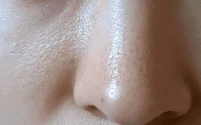 毛孔粗大还在使劲用面膜薏米百合粥帮你