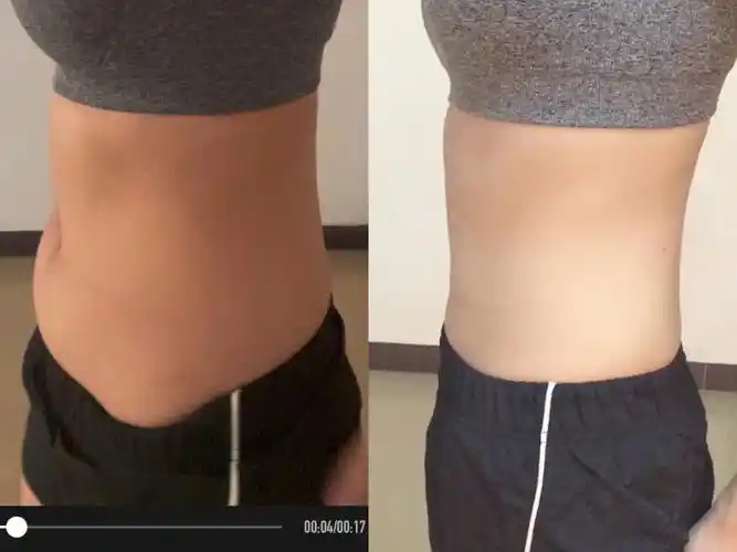 119斤瘦到105斤第二十天已瘦85斤