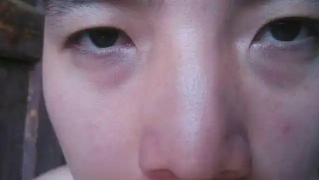 疲劳13,气血不足——有黑眼圈,没精神12,肝功异常——巩膜发黄,有红