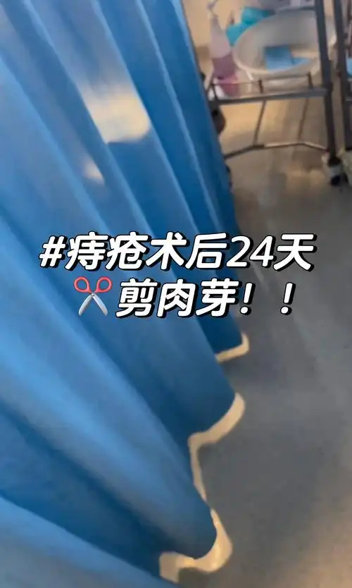 痔疮术后24天,小剪刀噶肉芽09