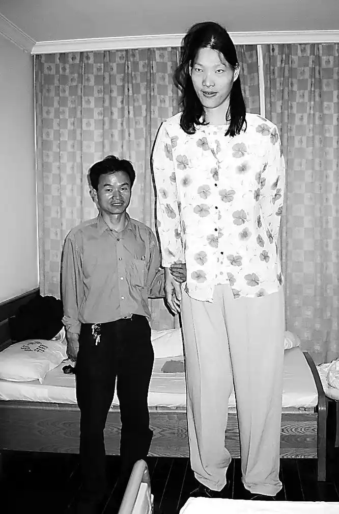 亚洲第一女巨人姚德芬身高236米穿78码鞋子死因让人心酸