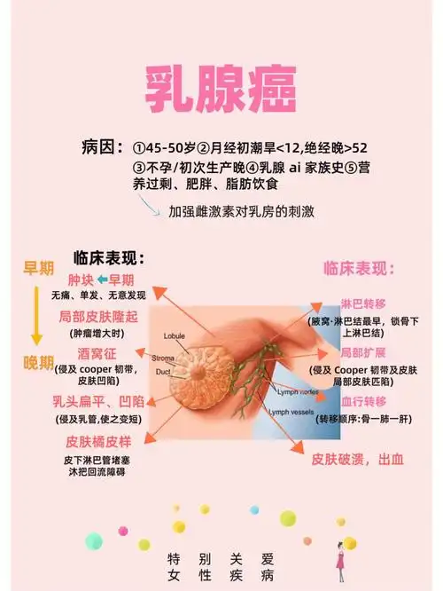 96随肿块增大,局部乳房隆起96酒窝征(癌侵犯cooper韧带,局部皮肤