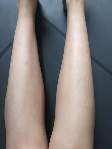 鸡皮肤光滑了怎么办(鸡皮肤光滑了怎么办图片)